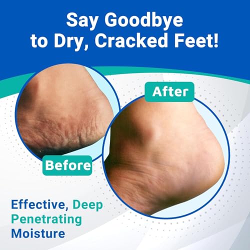 Dermal Therapy Heel Care Cream - Moisturizing Treatment that Repairs and Heals Dry, Rough, Cracked Heels and Feet | 25% Urea and 6% Alpha Hydroxy Acids (3oz+8oz Bundle)