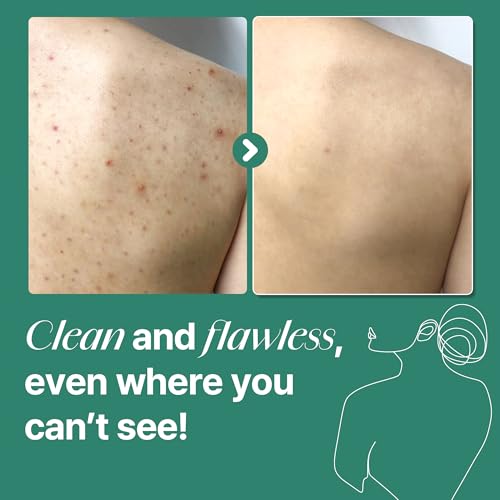 SOME BY MI AHA BHA PHA 30 Days Miracle Acne Clear Body Cleanser ? Pack of 2 ? Daily Exfoliating Tea Tree & Salicylic Acid Acne Body Wash ? Deep Cleanses Sebum, Oil & Impurities ? Korean Skin Care