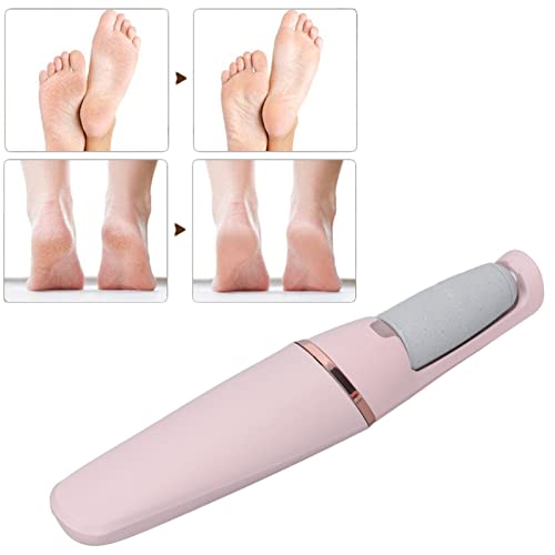 Staleks Pro Manicure Pusher UNIQ 10 Type 6 ? Silicone Handle ? Wide Rounded Pusher & Nail Cleaner