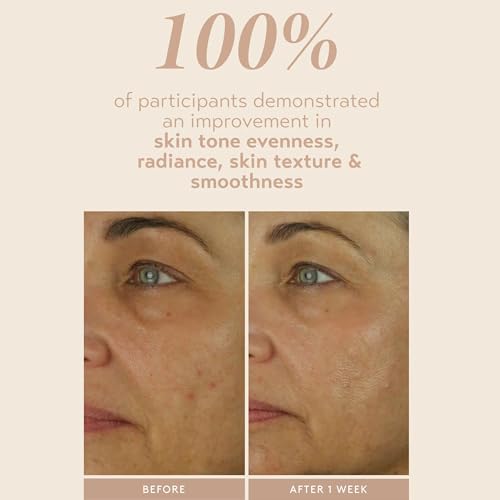 Travel Size Retinol Serum with Encapsulated 1% Retinol - Sensitive Skin Care
