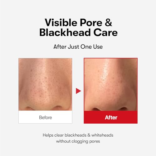 Azelaic Acid Cleansing Oil for Acne & Sensitive Skin - 200ml