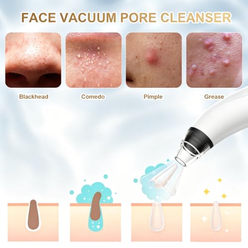 Blackhead Remover Vacuum Tool - Electric Pore Cleaner with Adjustable Suction (White)