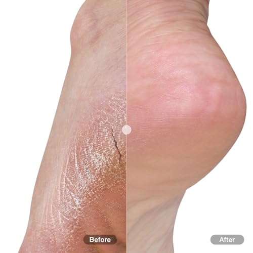Foot & Heel Balm Plus 50ml - Moisturizing Foot Care for Dry & Callused Skin