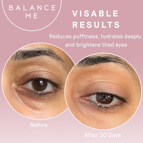 Hydrating Eye Cream for Dark Circles & Fine Lines - Natural & Vegan
