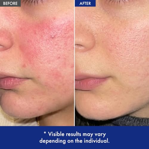 ATOSOOP 365 Barrier Cream with 5% Panthenol & Ceramide for Sensitive Dry Skin