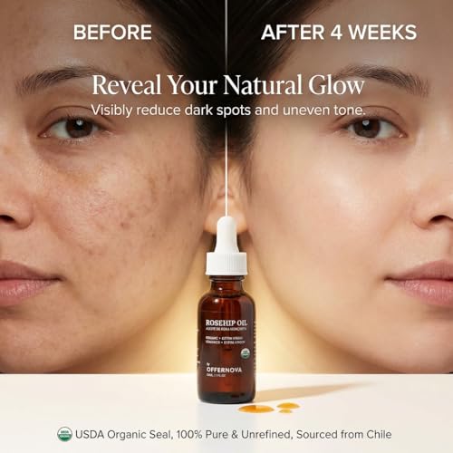 Organic Rosehip Seed Oil - Cold-Pressed Skin Nourishing Facial Body Oil 1 oz