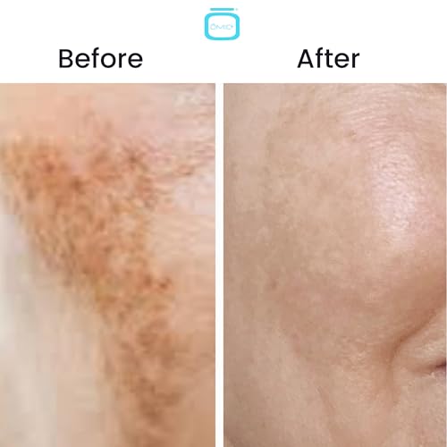 OMIC 10% Tranexamic Acid Cream ? 1 fl oz / 30ml ? Skin Brightening Cream, Reduce Appearance of Dark Spots, Skin Moisturizer, Even Skin Tone with Coconut Oil & Vitamin E
