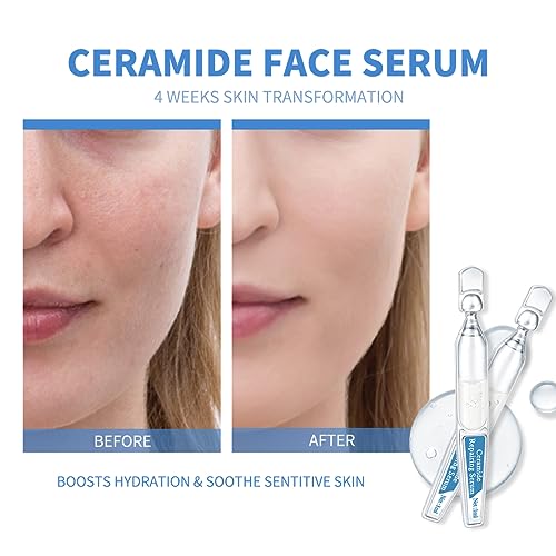 Ceramide Ampoule Serum with Hyaluronic Acid, Peptide, Hydrating & Anti Aging, Skin Barrier Repair Face Serum for Dry and Sensitive Skin, 30 Pcs/Box