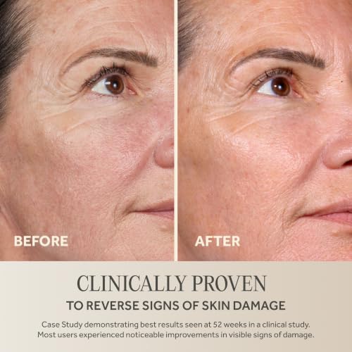 No7 Future Renew Damage Reversal Anti-Aging Face Serum 0.84 Fl Oz - Pack of 1