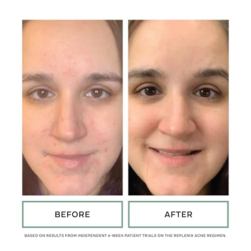 Gly-Sal Clarifying Acne Pads 5% Glycolic Acid & 2% Salicylic Acid - 60 Count