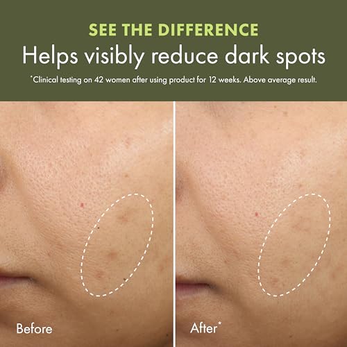 Dark Spot Corrector Cream with Vitamin C & Reishi Mushroom - Brightening & Even Skin Tone - 1.7 Fl Oz