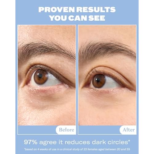 Then I Met You Snail Mucin Eye Cream, Korean Skincare for Dark Circles, Puffy Eyes, Fine Lines & Dehydrated Skin, Firming, Brightening and Plumping Treatment with Volufiline* & Caffeine, 0.51 oz