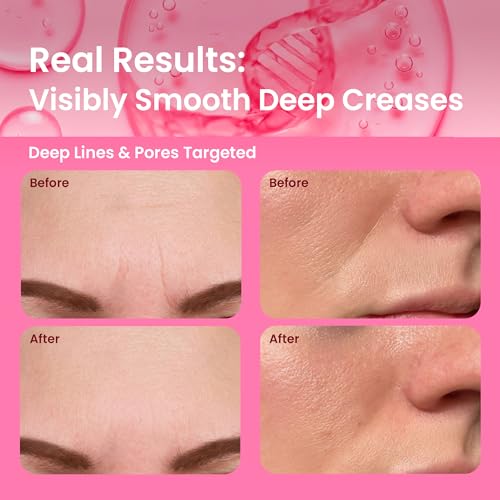 PDRN Collagen Wrinkle Patches for Face - Hydrating Anti-Aging Mask 60 Count