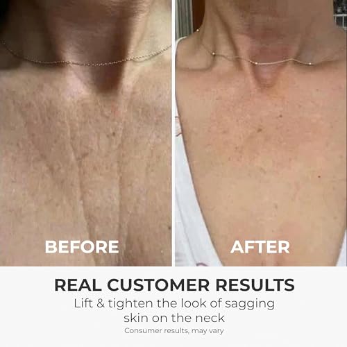 Neck Cream, Tighten & Lift Neck Cream - Anti-Aging Neck Creams for Tightening Lifting Sagging Skin and Hydrating- With Pro-Active Repair Firming Complex, 1.8 oz