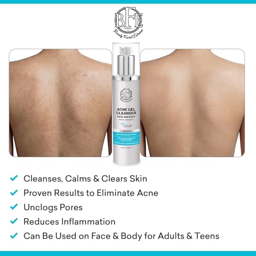 Acne Face Wash Treatment with 10% Benzoyl Peroxide for Oily Skin & Breakouts