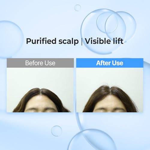 KUNDAL Airy Volume Hyaluron Shampoo & Conditioner Set – Blossom Breeze, 10.14 fl oz Each