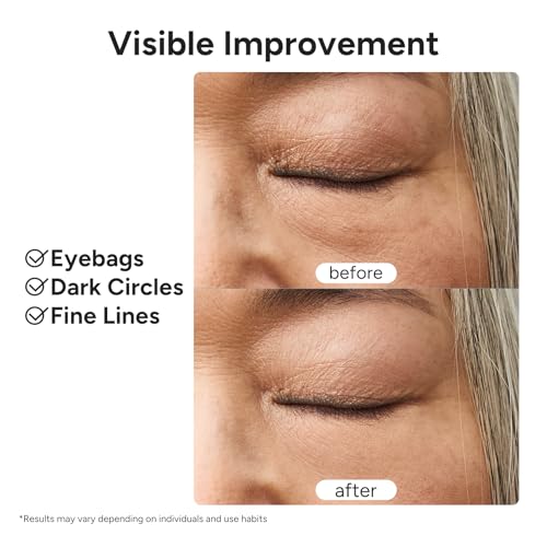 In My Eyes Eye Repair Gel Cream - Under Eye Cream with Caffeine & Lutein, Anti-Wrinkle and Firming, Treatment to Reduce Dark Circles, Fine Lines & Puffiness, 0.5 oz.
