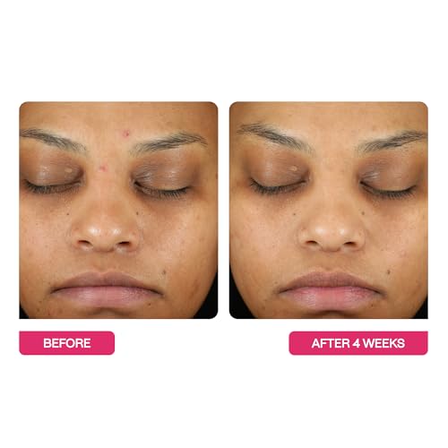 BeautyStat Exfoliating Peel Pads - 30 Count AHA BHA Chemical Face Peel