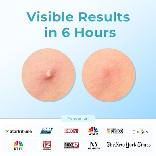 Hydrocolloid Pimple Patches (Made in Korea) FSA/HSA Eligible - Vegan, Hypoallergenic, Cruelty-Free Acne Circle Stickers for Overnight Use, for Zits, Spots, Pimples, Whiteheads (46 Count, Mixed Sizes)