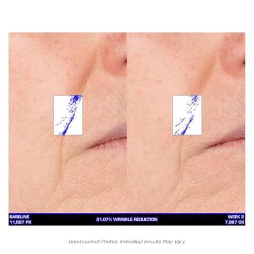 Serious Skincare Ultra-Mare Marine Infusion Facial Serum - Collagen, Cell Turnover, Plumper Skin, Niacinamide, 2 oz