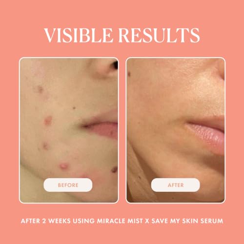 LUMIONskin Miracle Mist Purifying Hypochlorous Acid Spray 3.4 oz - Calming & Hydrating Face Mist (Variation of THIS listing)