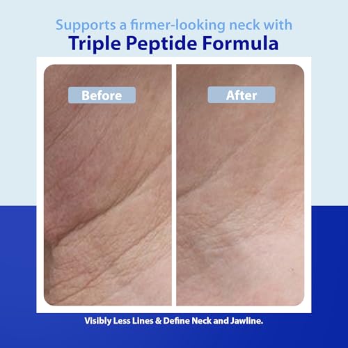 Dr. Denese Triple Strength Neck Wrinkle Smoother - Firming Cream 4oz