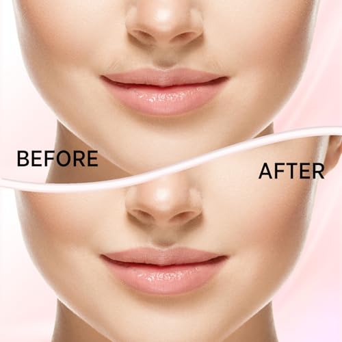 Facial Hair Removal for Women: Electric Face Razor with LED Light - Painless & Instant Results Mini Shaver for Travel Use (Rose Gold)