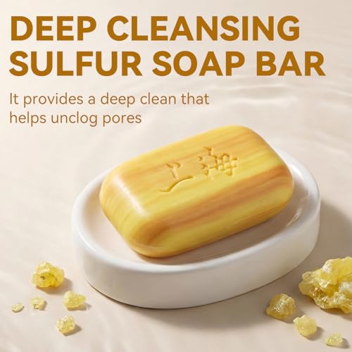 Sulfur Acne & Body Soap Bar 10% - Pack of 6, Face & Skin Treatment