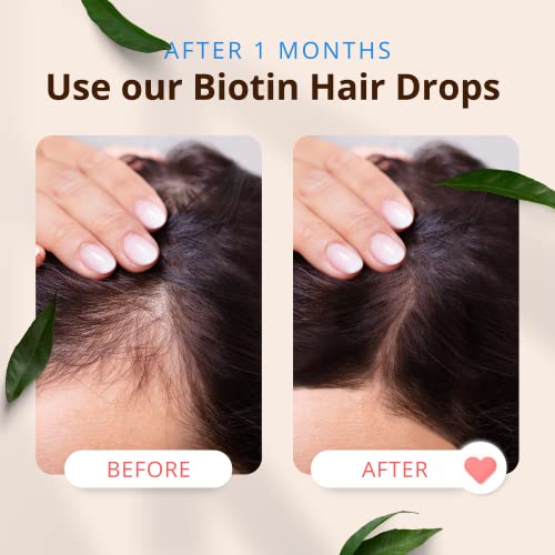 Morfose Biotin Hair Drop - Nourishing Hair Growth & Strengthening for All Hair Types (3.38 Fl Oz)