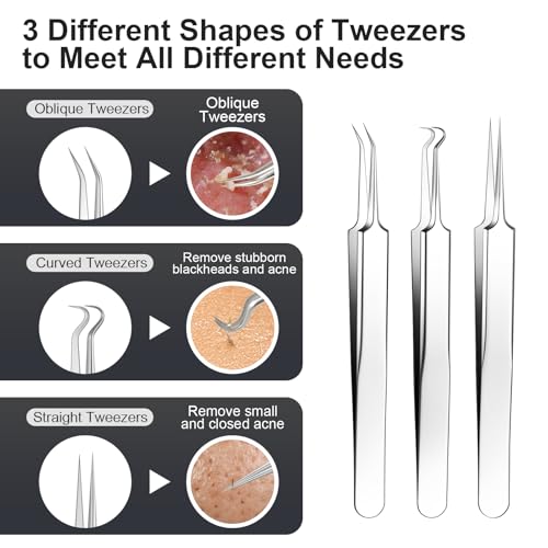 Silver Blackhead Remover Kit 11Pcs with Magnifying Glass & Alcohol Pads - Acne Extraction Tools