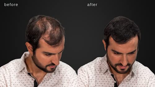Hair Building Fibers for Thinning Hair - Natural Thickening - Dark Brown - 2 Months+ Supply