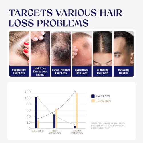RootStim Hair Growth Serum with Biotin & Herbal Extracts - Thinning Hair Treatment for Men & Women
