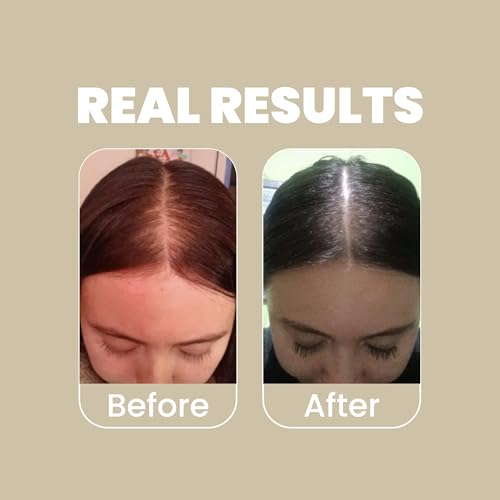 Rosemary Shampoo & Conditioner Duo with Hyaluronic Acid - Refreshing 2-Pack