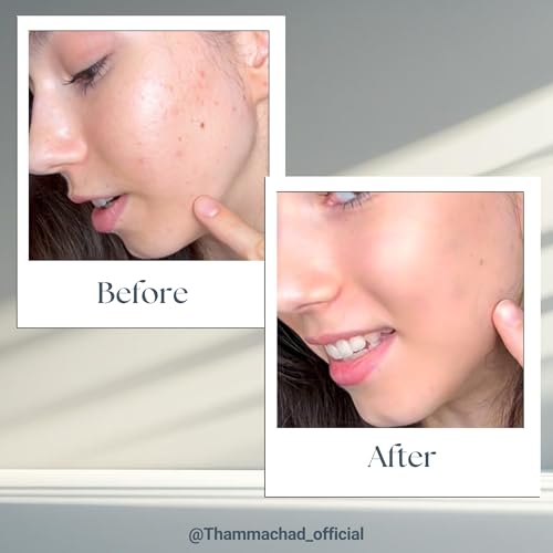 Thammachad Face Oil ? 8 Premium Botanical Oils for Radiance, Anti-Aging, Deep Hydration & Glow boost ? 100% Natural Blend | Non-Comedogenic ? Lightweight for All Skin Types ? 30ml