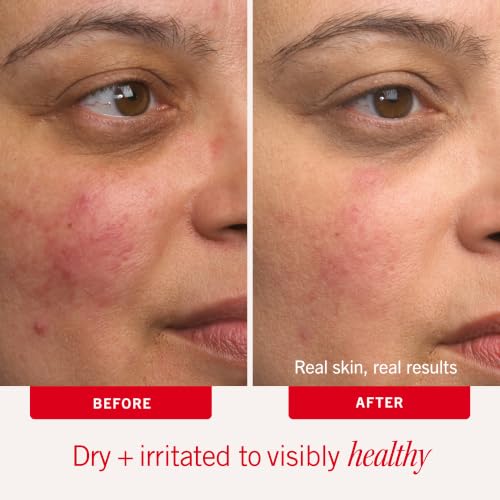 First Aid Beauty Ultra Repair Cream 4oz - Intense Hydration, Repair & Relief