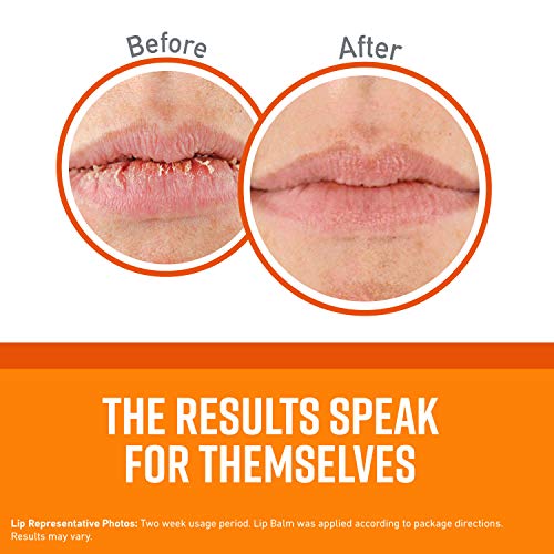 O'Keeffe's Unscented Lip Repair Balm Pack of 8 - Long-Lasting Hydration, Deep Healing