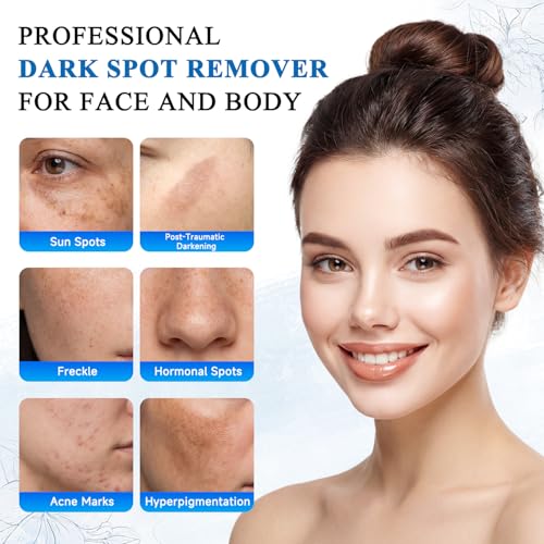 Dark Spot Remover for Face and Body, Dark Spot Corrector, Sun Spot Freckles Hyperpigmentation Treatment, Advanced Dark Spot Remover Cream with Niacinamide for Women and Men (1.7 Fl Oz)