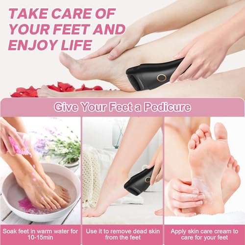 Spriak 16-in-1 Electric Callus Remover Foot File for Pedicure, Black
