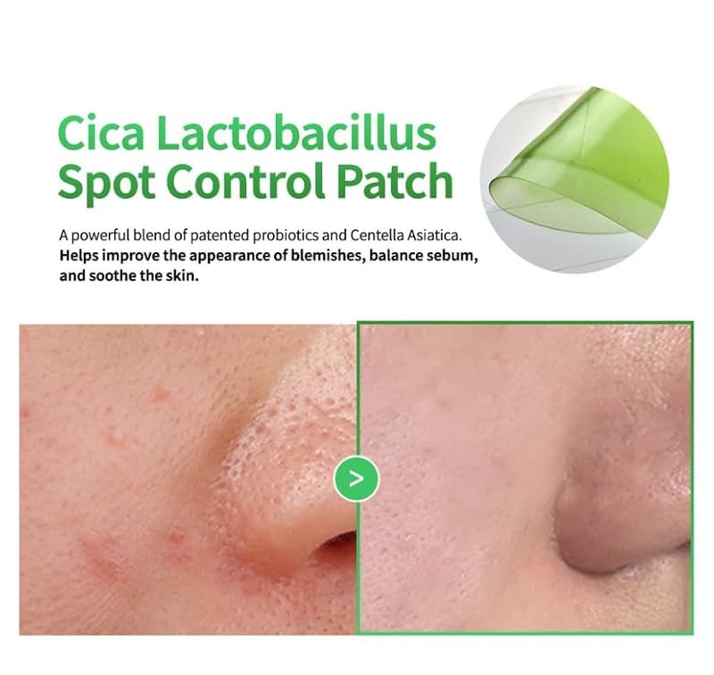SLLIGHT Cica Hydrocolloid Acne Patches - Redness & Blemish Treatment, 62 Patches