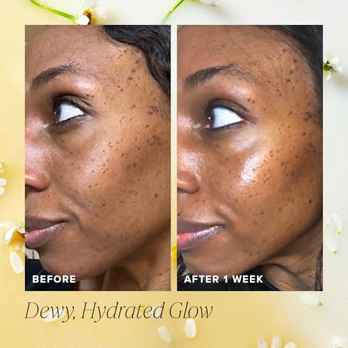 Hydrating Honey Milk Essence & Ceramide Moisturizer Duo for Skin Barrier & Glow