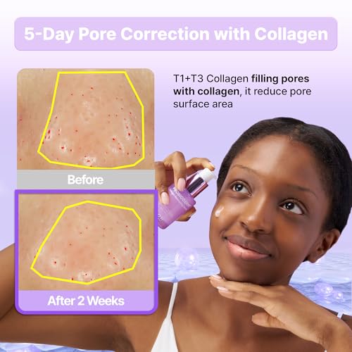 BIOHEAL BOH Collagen Remodeling Serum + Gel Mask | Firming & Pore-Tightening Skincare Set with Collagen & Peptides | Hydrating Daily Serum + 6 Hydrogel Masks