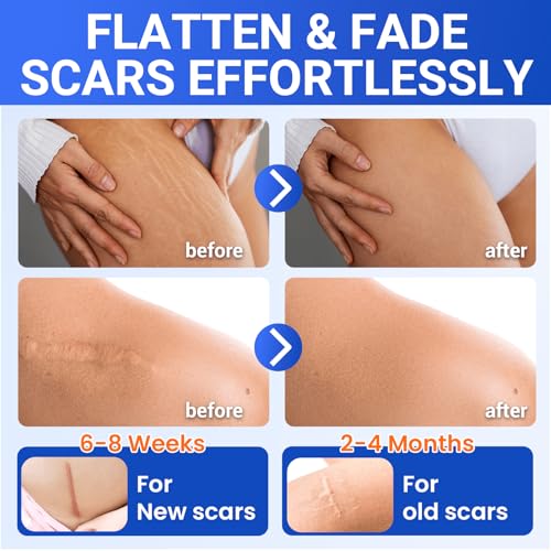 Silicone Scar Sheets Surgical Tape (1.6¡±x120¡± Roll) Face Patches Acne Treatment C Section Strips, Skin-Sensitive Medical Grade Healing Scar Bandages Pads for Keloid, Stretch and Tummy Tuck Recovery
