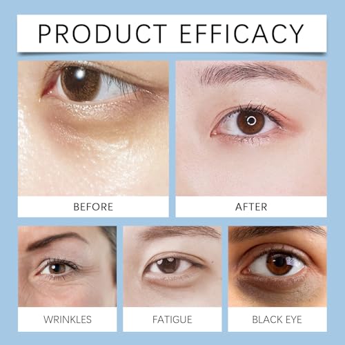 Instant Firming Eye Serum - Anti-Aging Formula, Reduces Under-Eye Bags, Wrinkles, Dark Circles, Fine Lines & Crow'S Feet9£¨3PCS£©