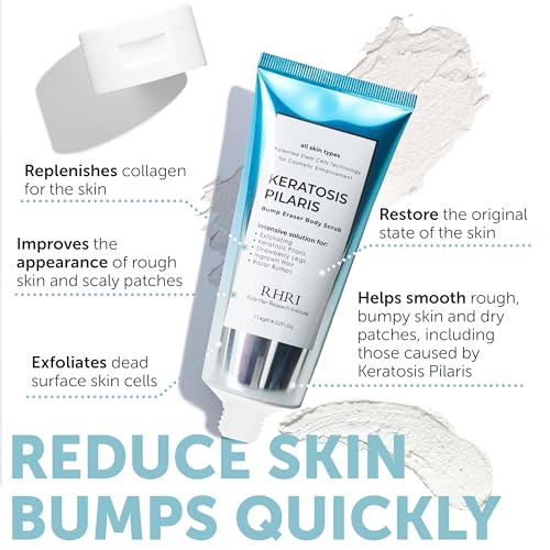 KP Bump Eraser Body Scrub with 10% AHA - Keratosis Pilaris Treatment - KP Scrub