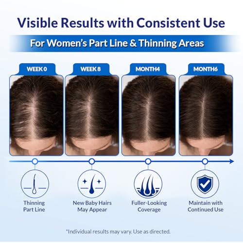 Minoxidil 5% Hair Regrowth Serum for Men & Women - 2 Pack with Dropper