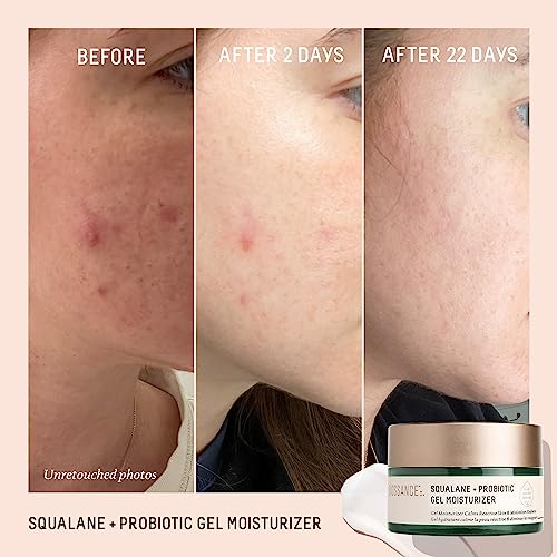 Biossance Squalane + Probiotic Balancing Face Gel Moisturizer - Advanced Formula for Oily & Acne-Prone Skin, Encapsulated Probiotics, Reduces Redness & Excess Oil, Soothes Sensitive Skin - 1.69 oz