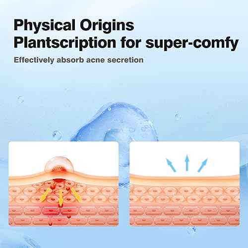 Pimple Patches for Face, Colorful Hydrocolloid Acne Patches, Cute Star Zit Covers for Face, Spot Stickers with Tea Tree, Salicylic Acid & Cica Oil| 4 Sizes (8mm, 10mm, 12mm & 14mm) |357 Count