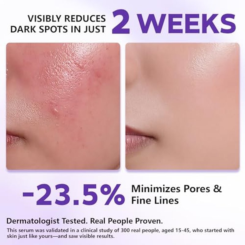 14% Tranexamic Acid Niacinamide Serum 30ML, Korean Facial Glass Skin Care Centella Serum Dark Spot Corrector Cream, Reduces Pigmentation Uneven Skin Tone, Pore Care for Sensitive Skin 1.01 FL.OZ