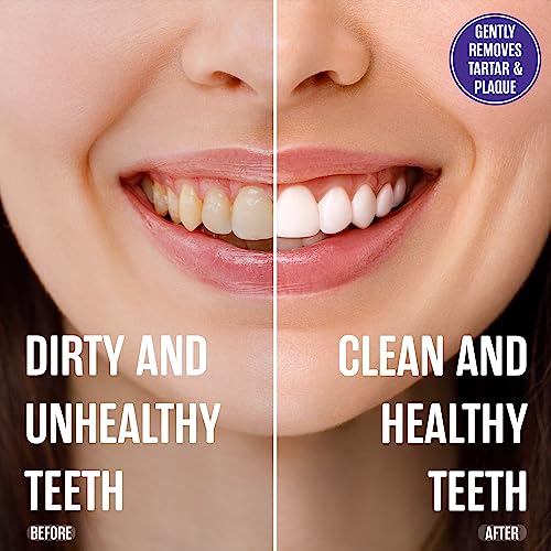 Fluoride Free Toothpaste for Sensitive Teeth - Black Seed Oil & Zinc, 4 Pack - Vegan & Natural - Sensitivity Variant