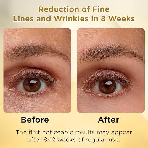 O'KADY Vitamin C & E Facial Serum with Niacinamide + Hyaluronic Acid, Skin Enhance Natural Radiance Serum to Support Skin Tone, Hydration & Smooth Texture